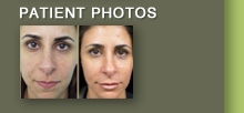 Patient Photos
