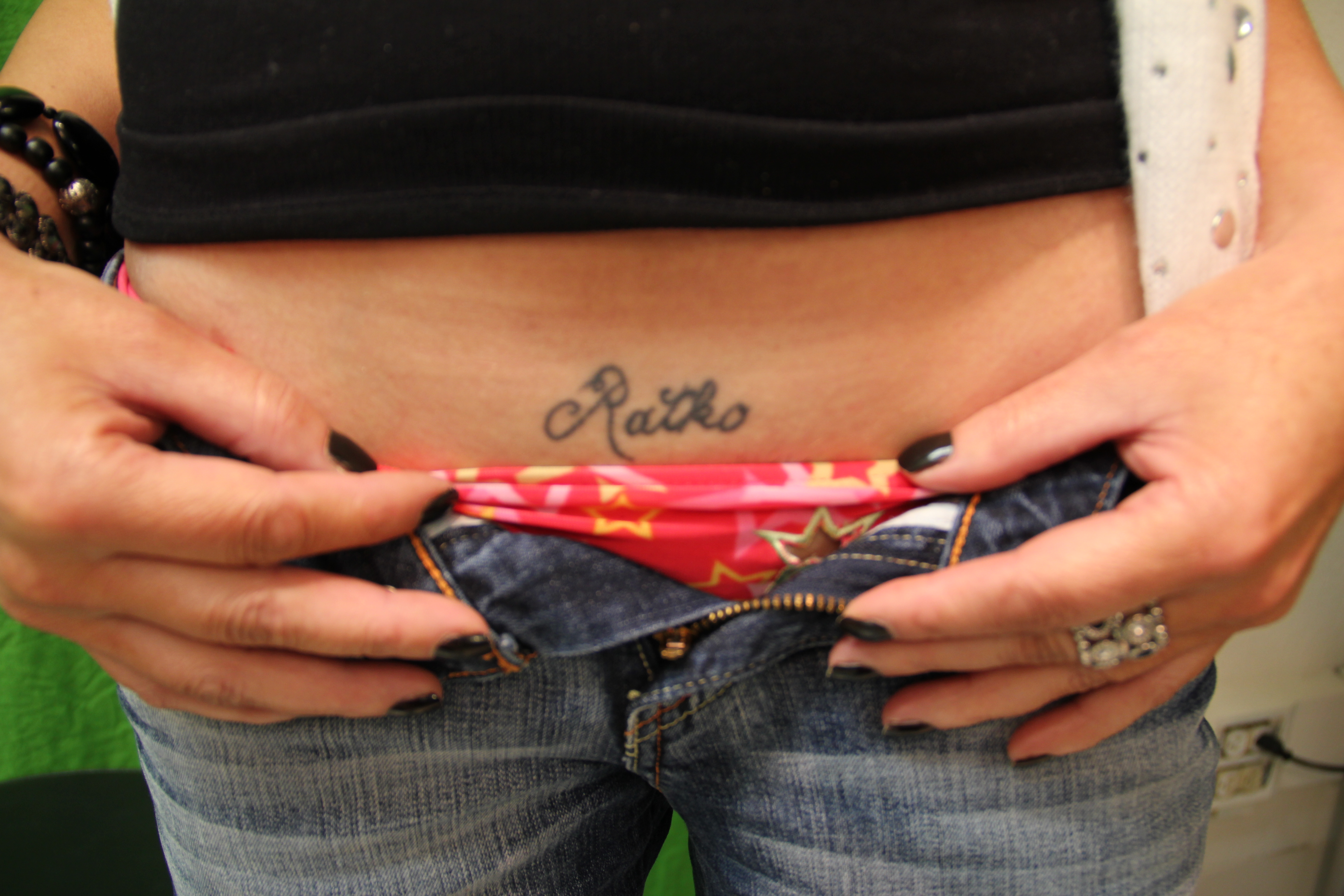 Laser Tattoo Removal Results on Abdomen