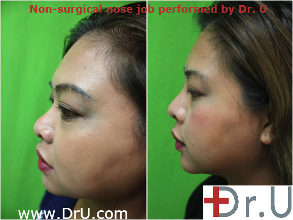 Patient Photos of Skin Treatments Performed By Dr. U