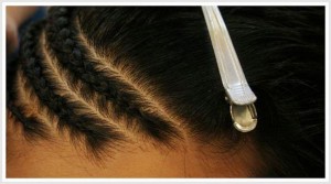 Traction alopecia can result from tight braids and cornrows.