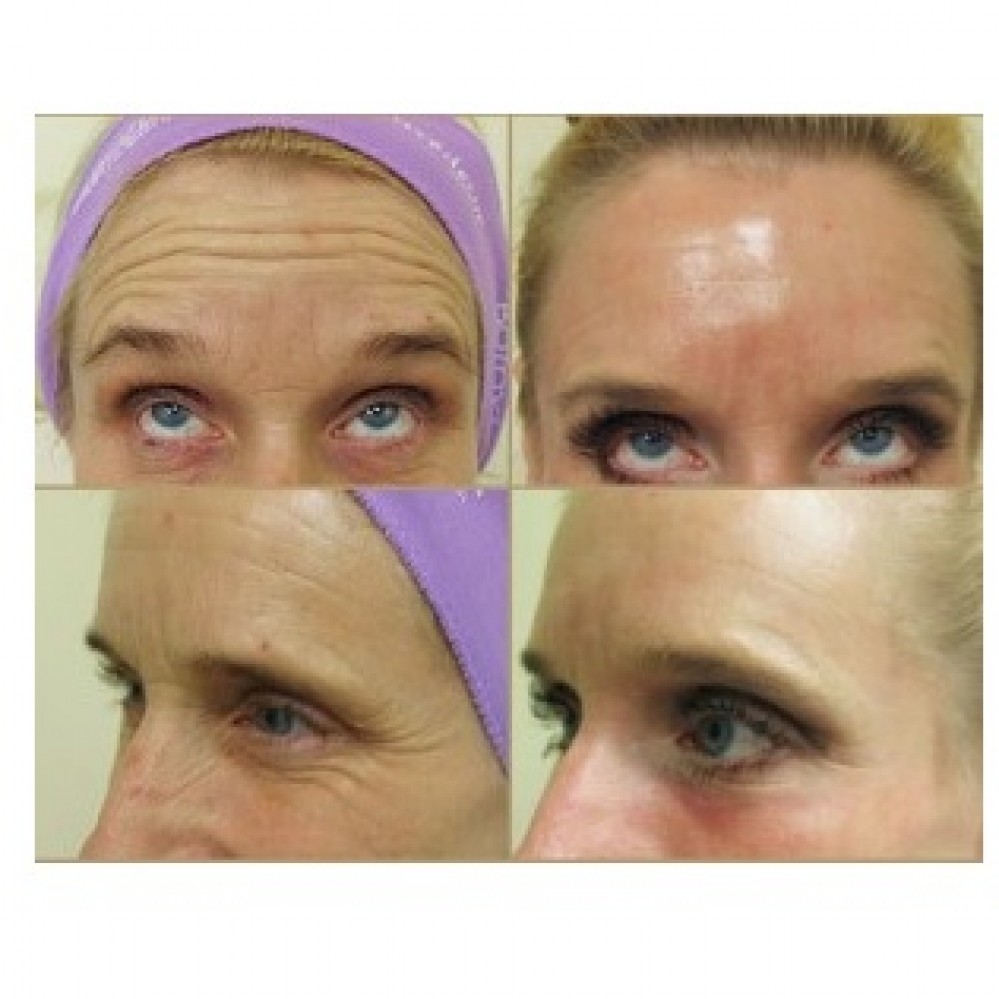 Watch Them Fully Ignoring Laser Dermatologist London And Be Taught The Lesson