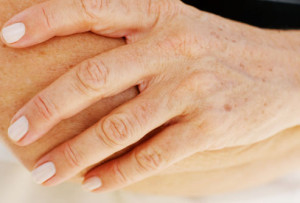 hand-rejuvenation-treatments-getty-www.webmd.com